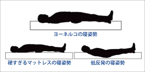 ヨーネルコのかたさ